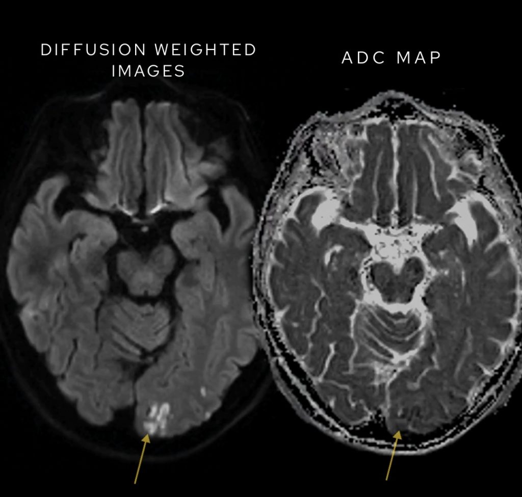 Space occupying lesions – the Radiologist