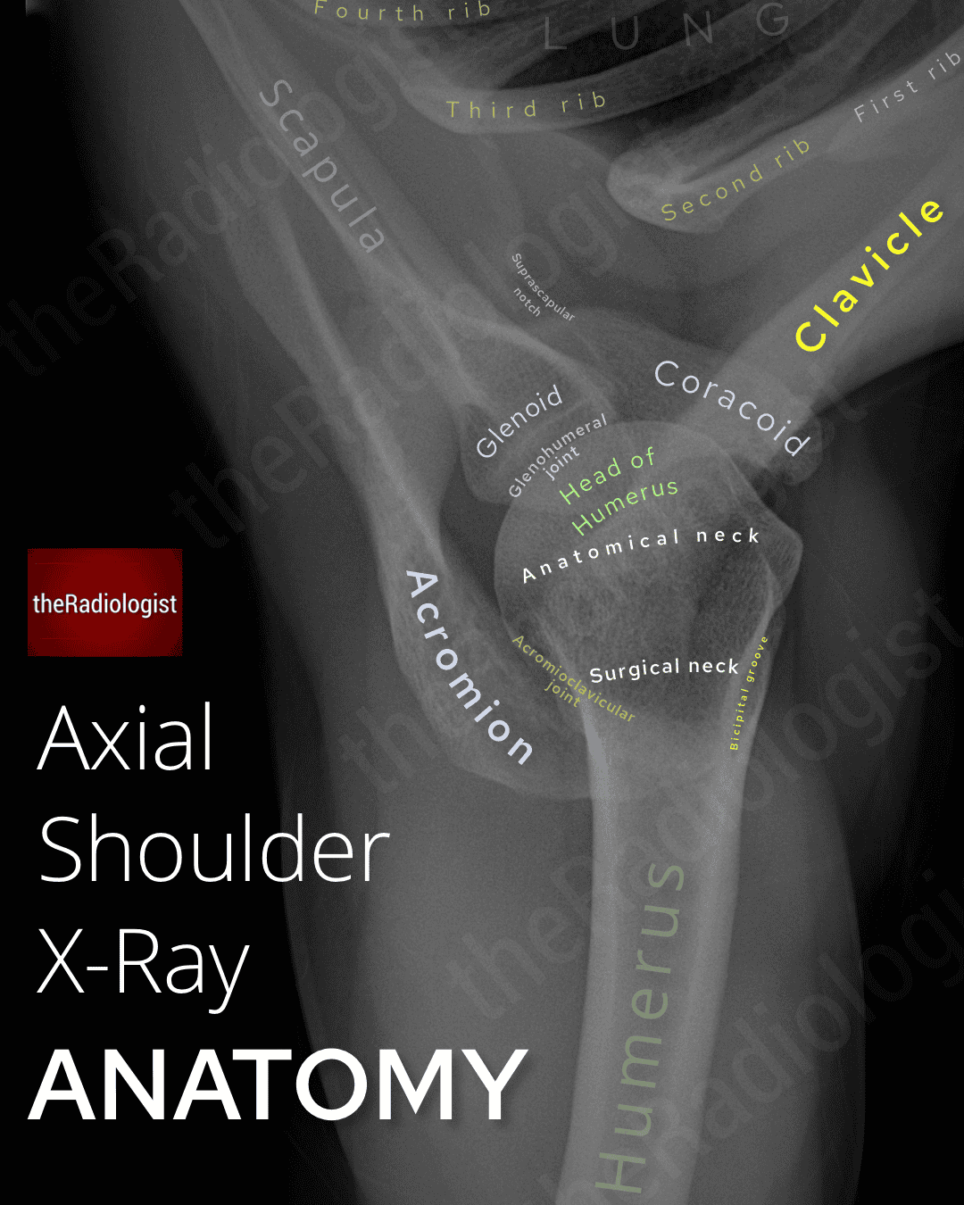 How To Read A Shoulder X Ray Anatomy And Views Guide