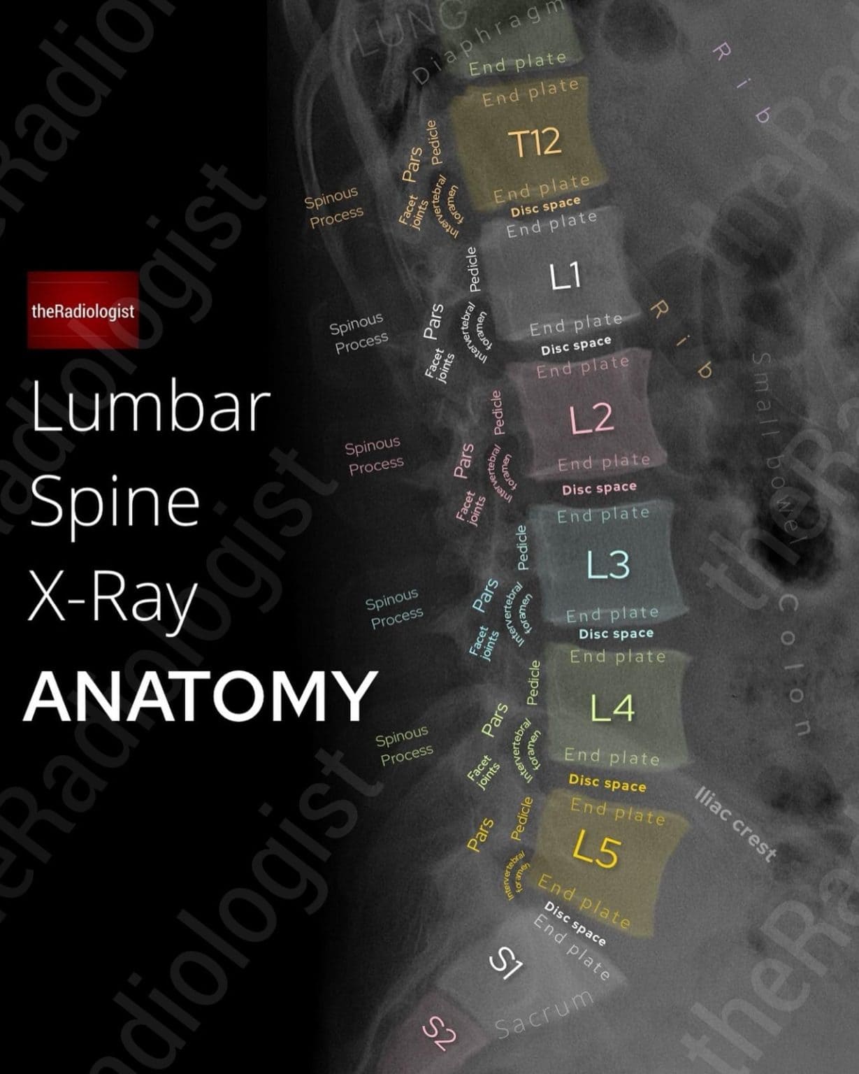 the-radiologist-anatomy-gallery-annotated-radiology-anatomy