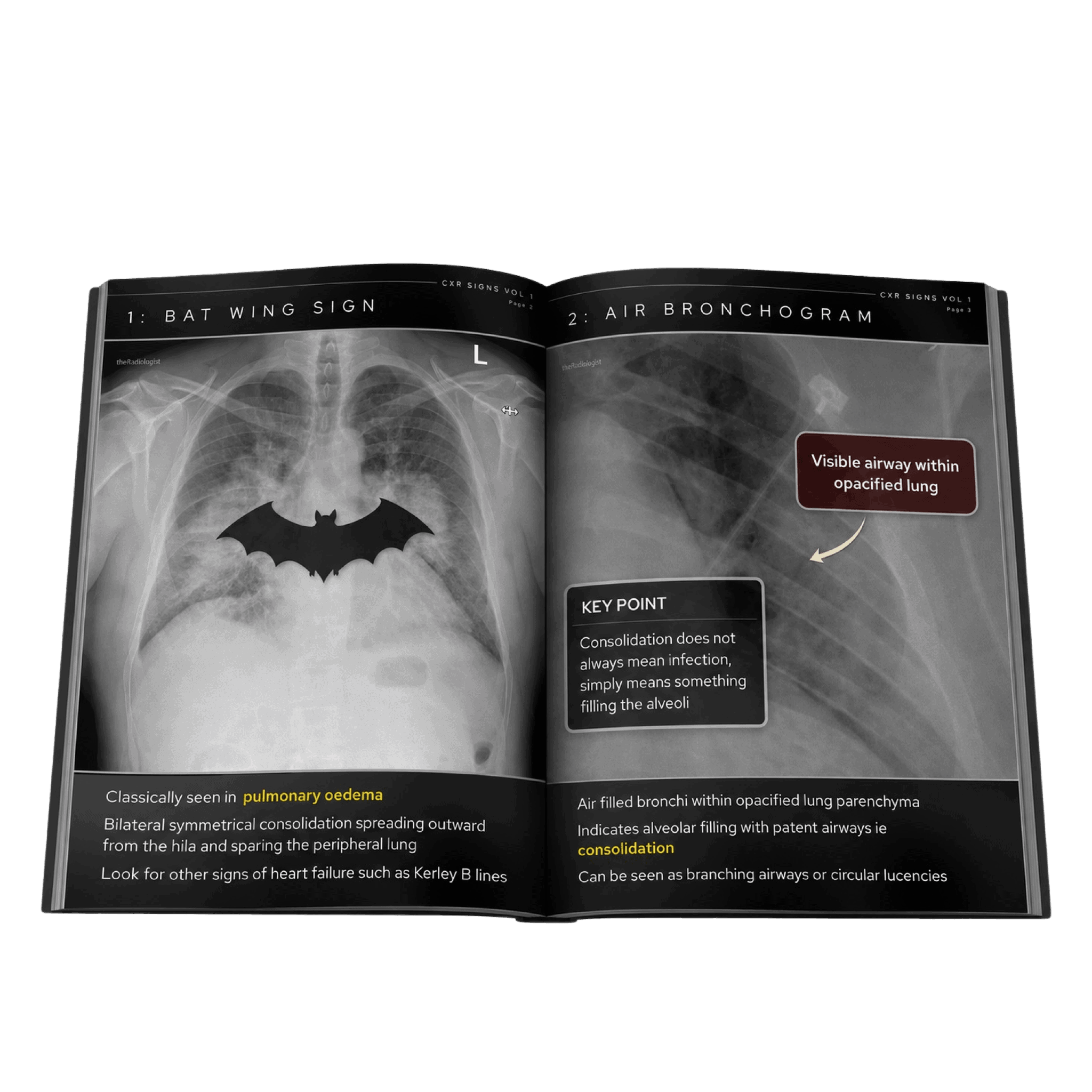Easy Learning Radiology The Radiologist | Radiology Learning Platform