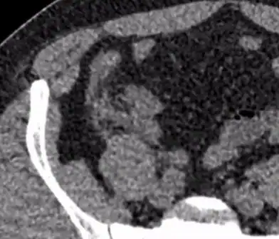 Radiologist reviewing a detailed medical scan for diagnosis.